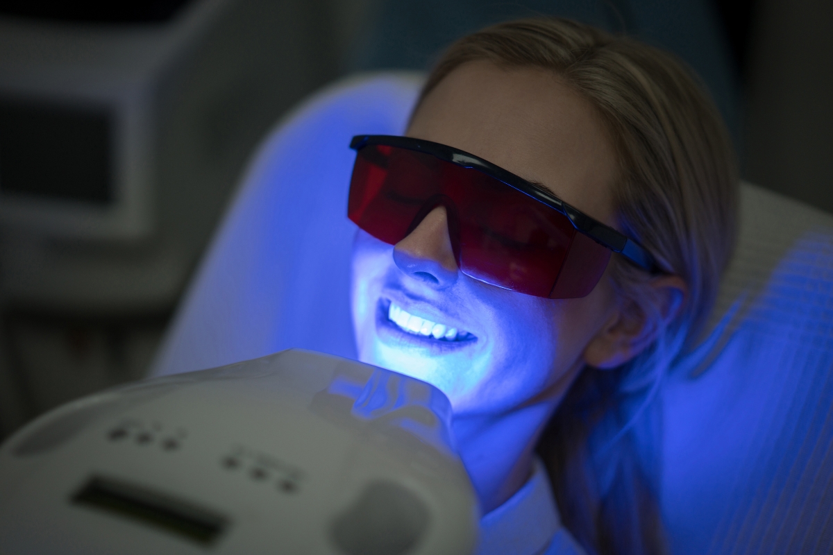 professional-teeth-whitening-in-San-Antonio