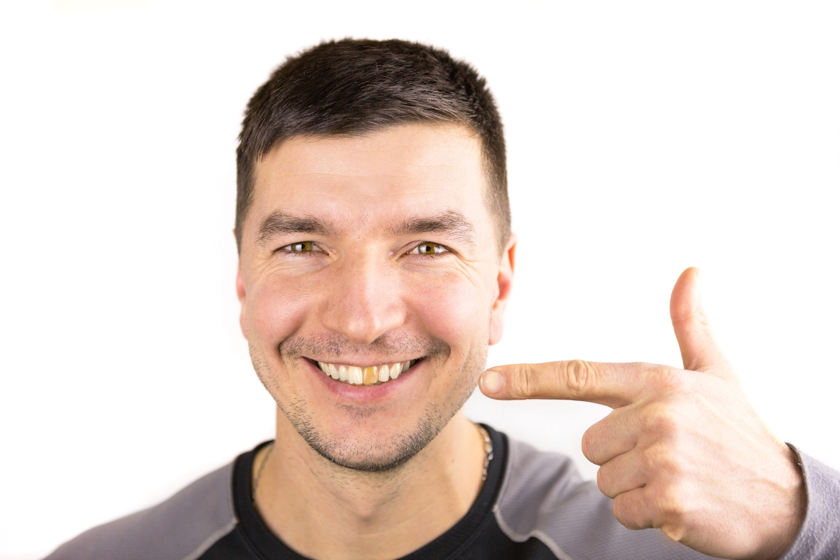 Man pointing to yellowing teeth, showing causes and treatment options in San Antonio