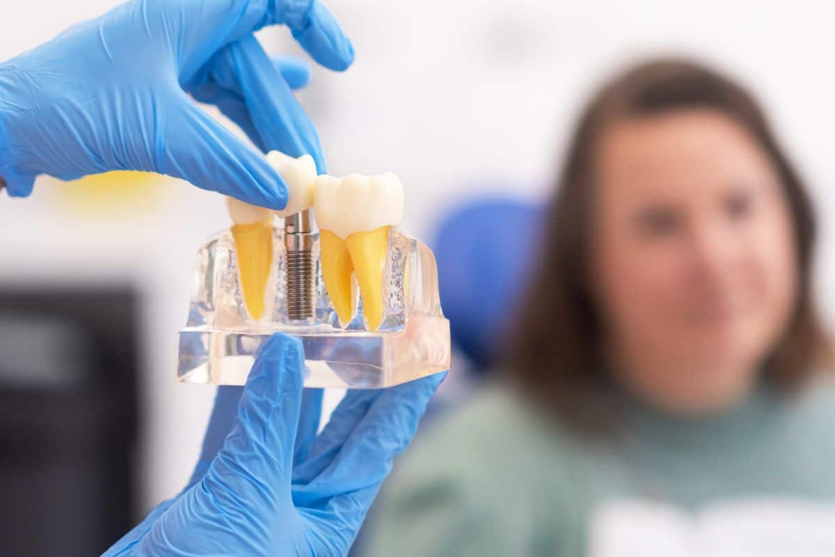 How Long Do Dental Implants Last? What San Antonio Patients Should Know